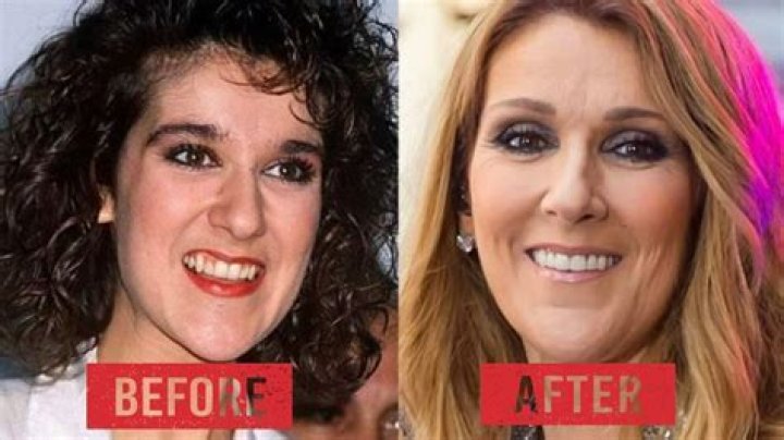 Celine Dion's Early Talent: Discover Her Voice At Age 12
