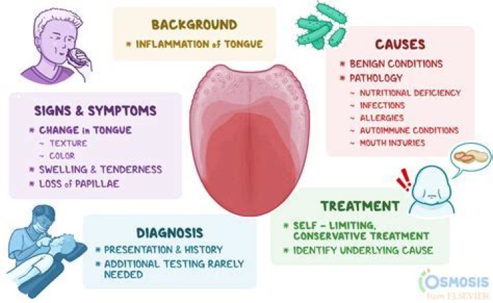 Definitive Guide To Drummond Diagnosis: Symptoms, Causes, And Treatment Options