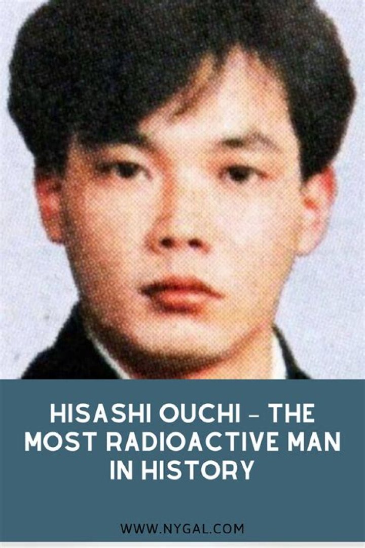 Discover The Significance Of Hisashi Ouchi's Body: A Scientific Enigma