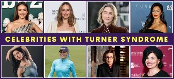 Famous Faces Of Turner Syndrome: Inspiring Women With A Unique Condition