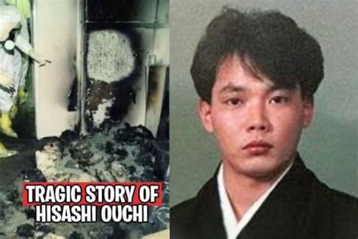Hisashi Ouchi Body: The Horrifying Story Of A Man Irradiated To Death