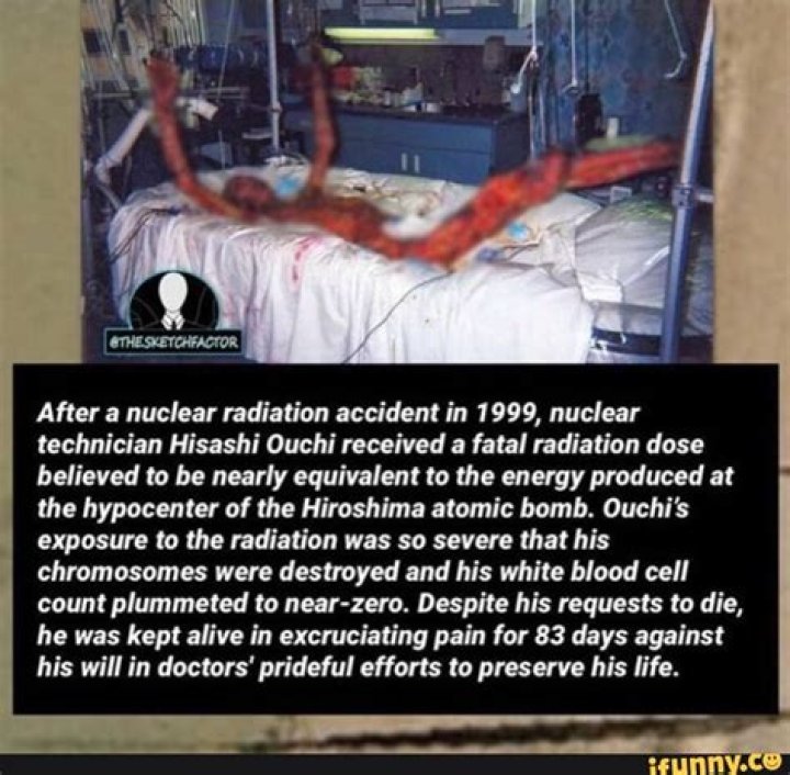 Hisashi Ouchi: The Tragic Tale Of Radiation Exposure's Deadly Effects