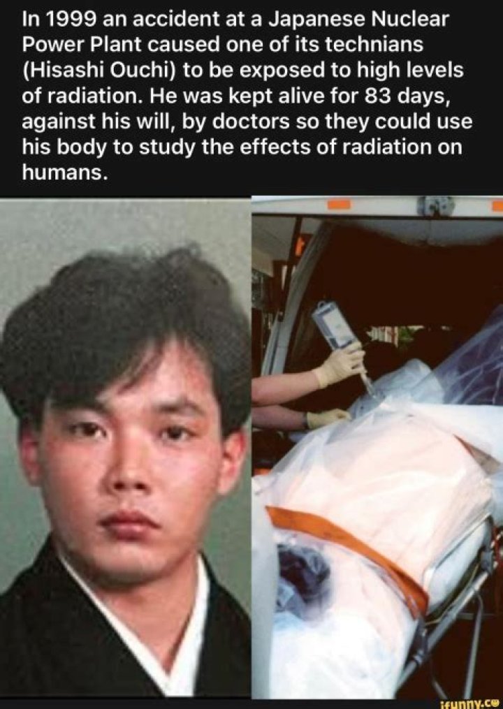 Hisashi Ouchi: The Unspeakable Horrors Of Radiation Exposure