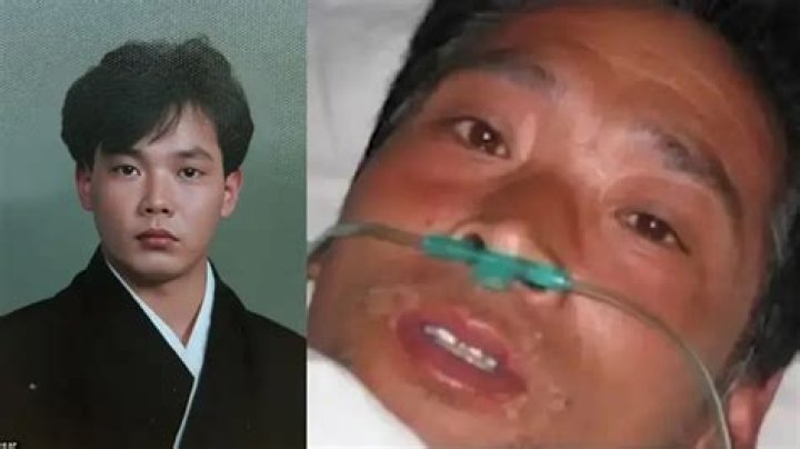 Surviving A Critical Tragedy: Hisashi Ouchi's Harrowing Story