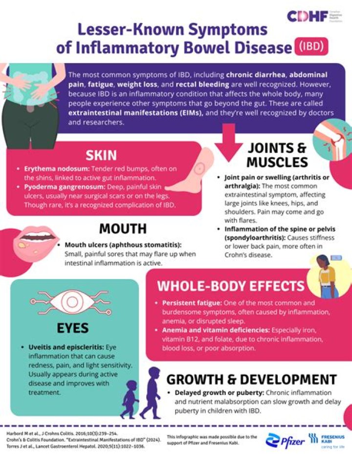 The Complete Guide To Ambani Disease: Symptoms, Causes, And Treatment