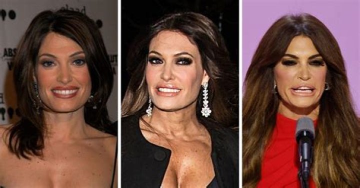 The Mystery Behind Kimberly Guilfoyle's Appearance: Why She Looks So Unique