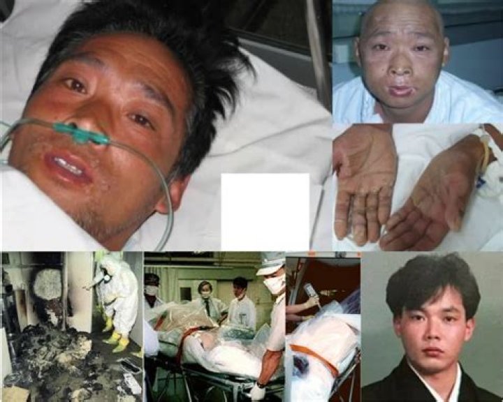 The Ultimate Guide To Hisahi Ouchi's Body: A Medical Marvel And Tragedy